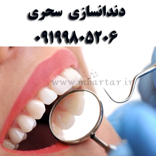 دندانسازی سحری