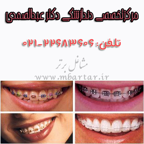 مرکزتخصصی دندازشکی دکتر عبدالصمدی