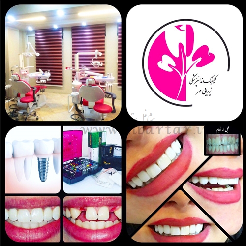 دندانپزشکی مهر