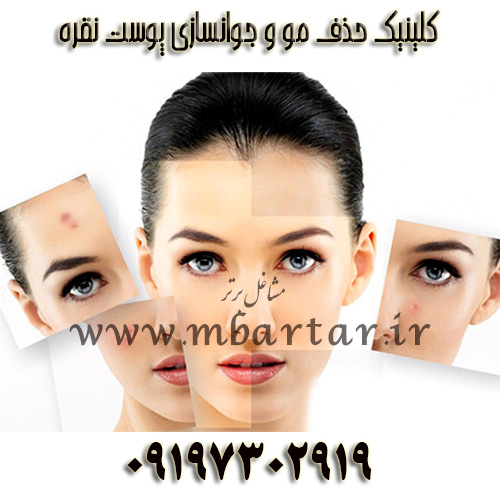 کلینیک حذف مو و جوانسازی پوست نقره