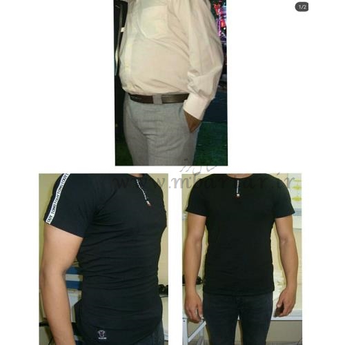 لاغری موضعی و رژیم درمانی